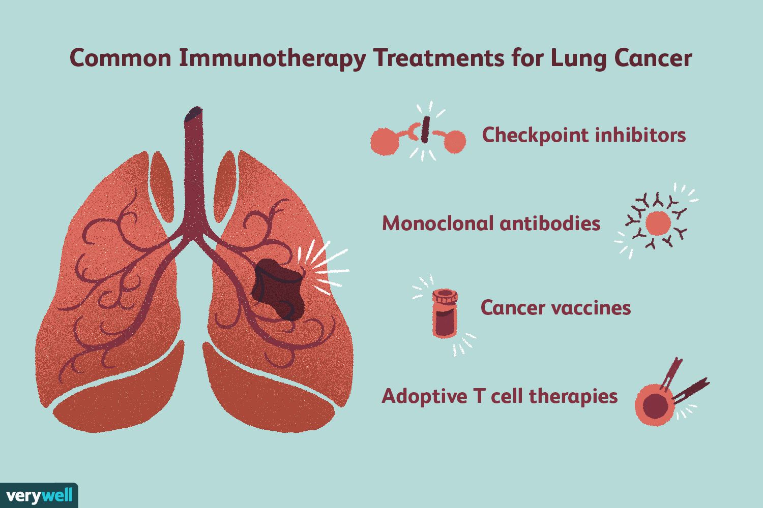 Immunotherapy in Lung Cancer: What Patients Should Know
